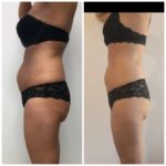 E27FE1D25AEB42BAAC5375256B53C1F6jpeg_5e299c02e3ed0